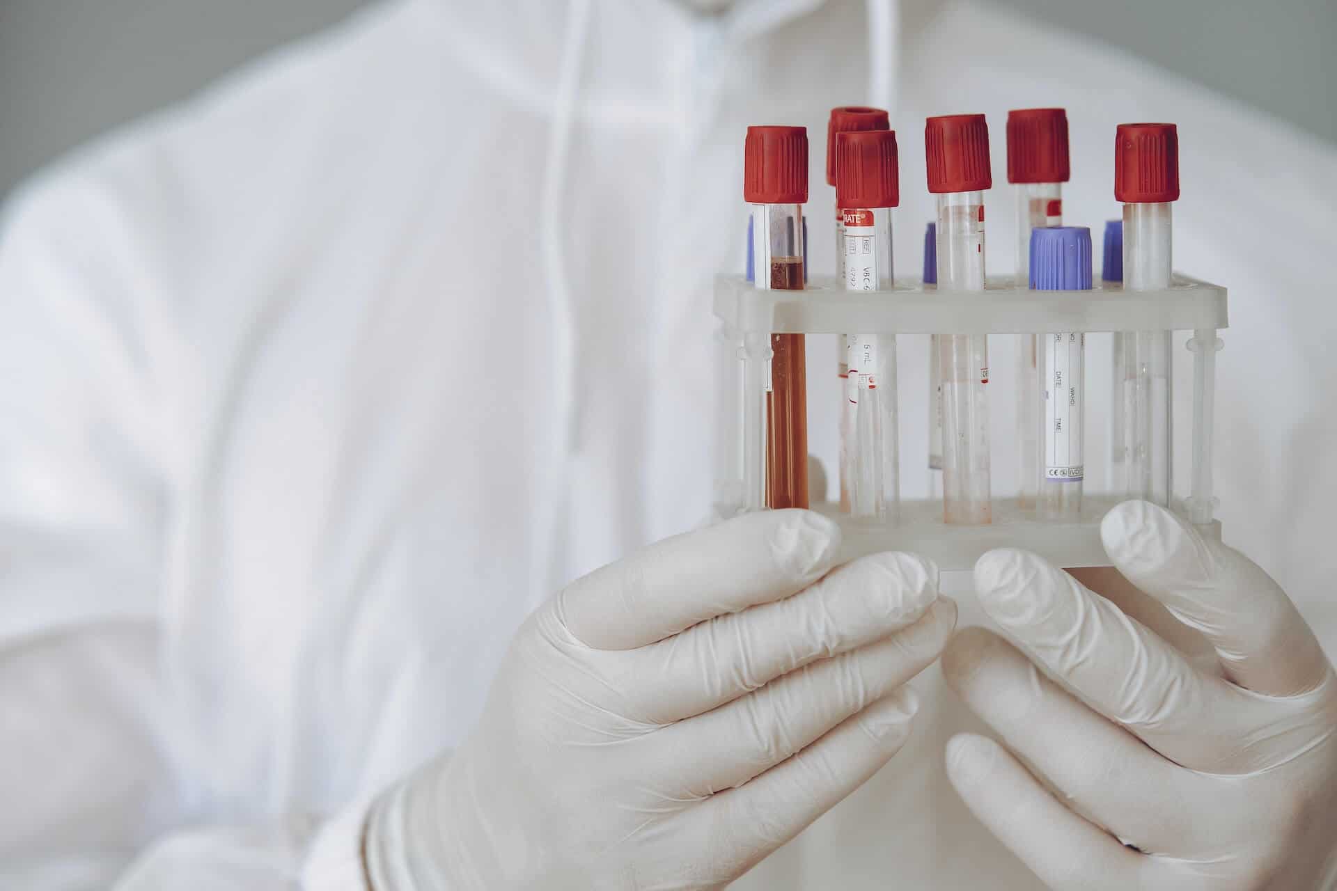 Person in white gloves holding a rack of test tubes with red-capped blood samples.