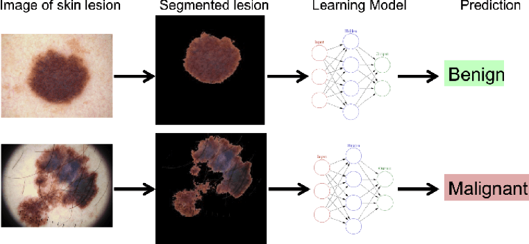 learning model of AI in healthcare