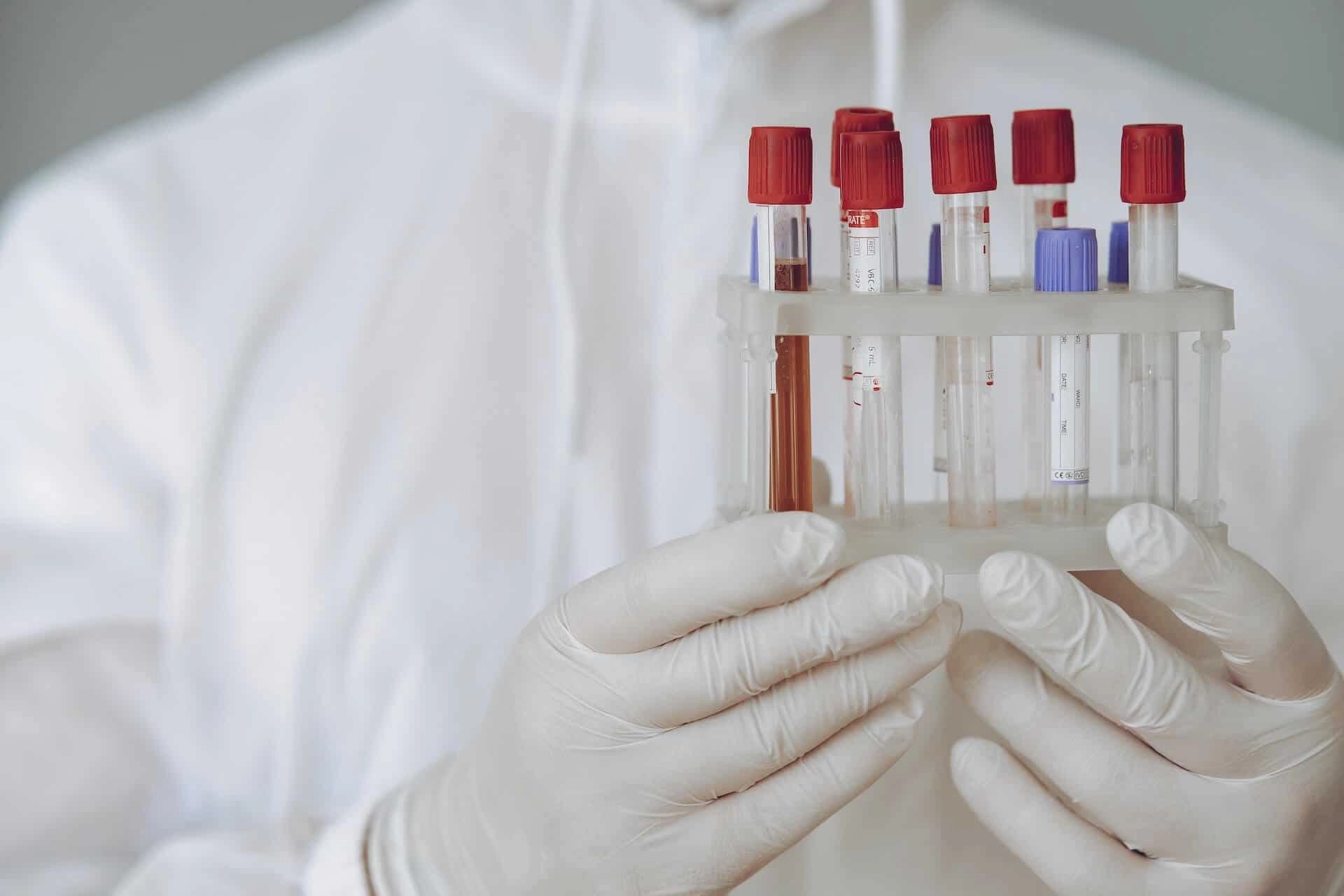 Laboratory work pictured in our cancer treatment demand forecasting case study